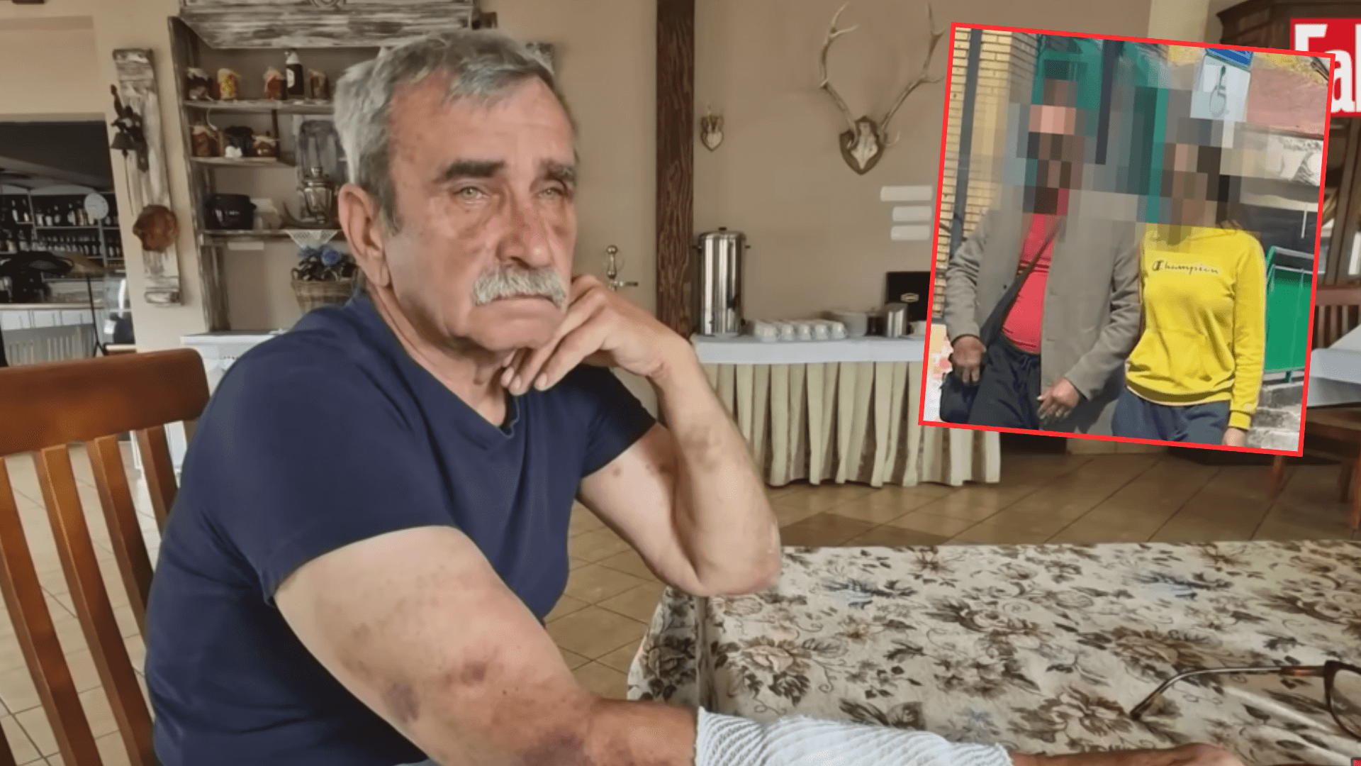 Całe Mielno w szoku. Upili się, skatowali pana Wojciecha i… wyszli na wolność. "Jestem pewien, że chcieli mnie zabić"