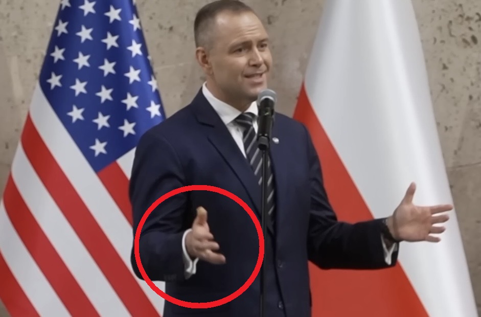 Nawrocki przemawiał, ale ciągle zerkał na swój… palec. Wszystko jasne! „Miał pewien problem”