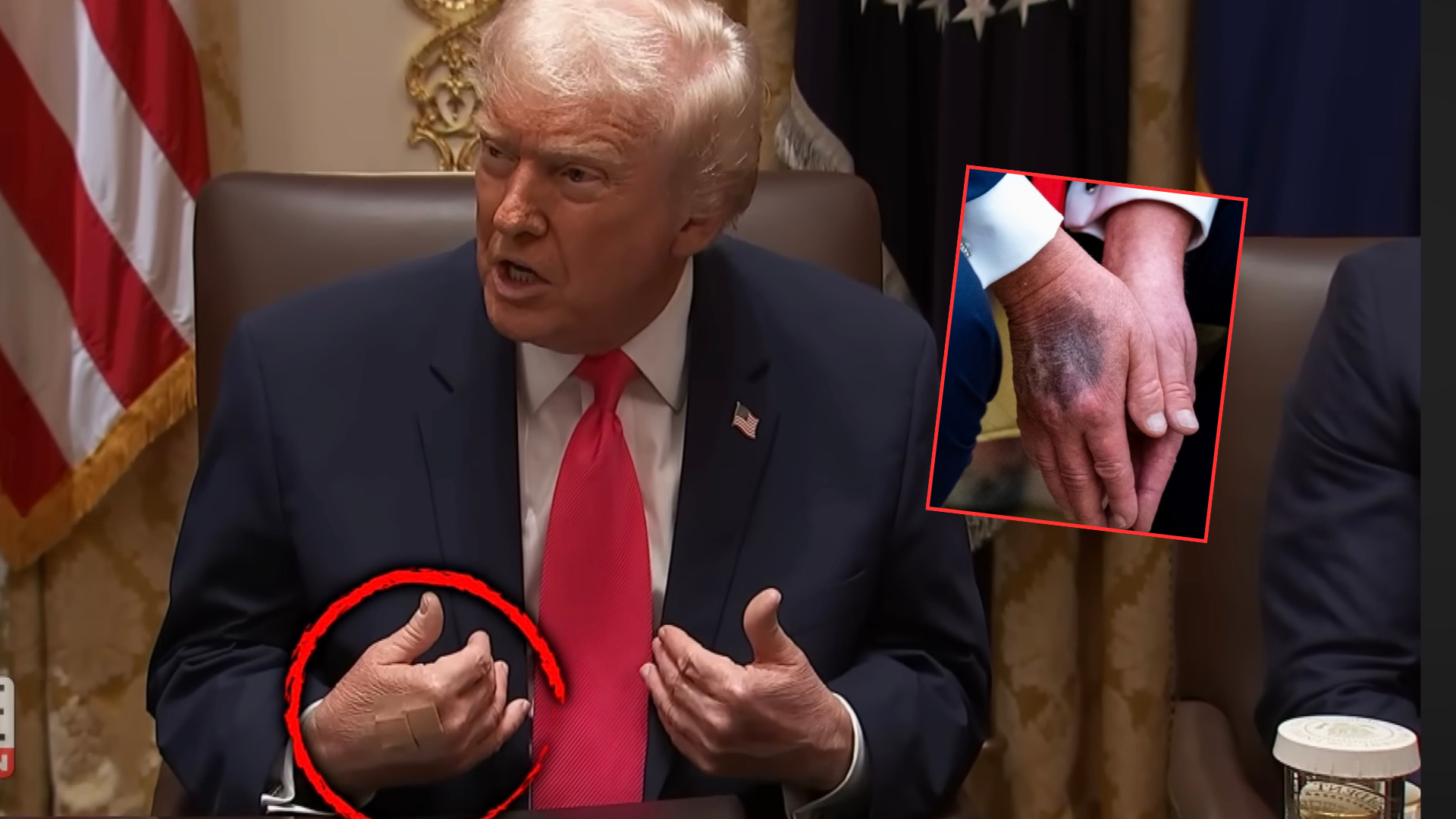 A jednak! Trump przejdzie badania, powraca temat tajemniczych siniaków. „Jestem znacznie młodszy niż senior”