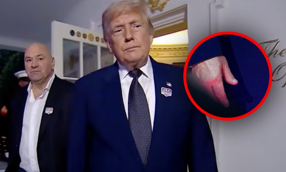 Donald Trump choroba