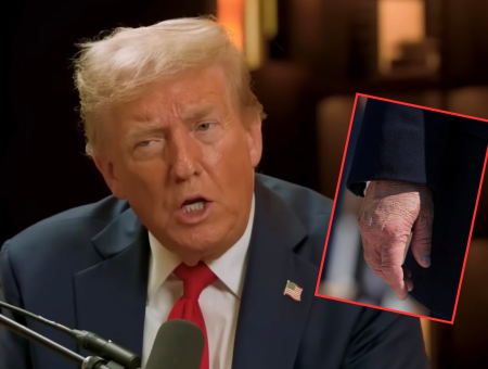 Donald Trump chory 